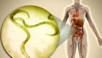 Comment se débarrasser des parasites dans le corps