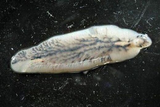 douve du foie chez l'homme