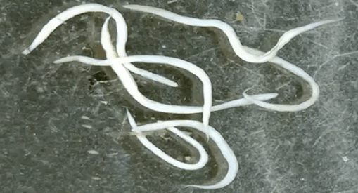 oxyures dans le corps humain