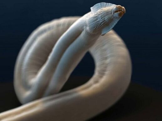 toxocara du corps humain