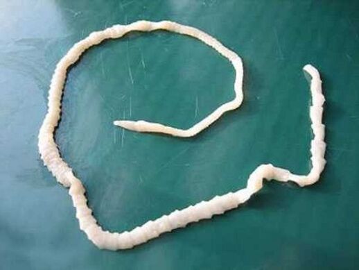 ténia du porc humain