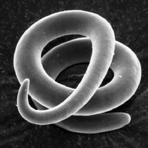 ver parasite trichinella chez l'homme