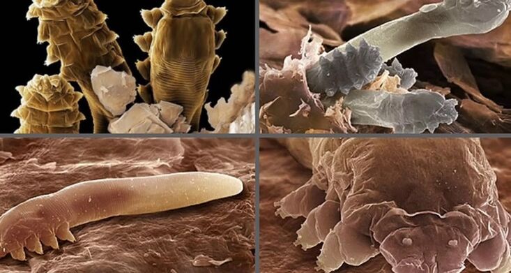 types de parasites cutanés humains