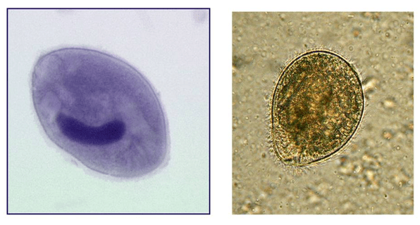 Balantidia ciliés, parasites du gros intestin